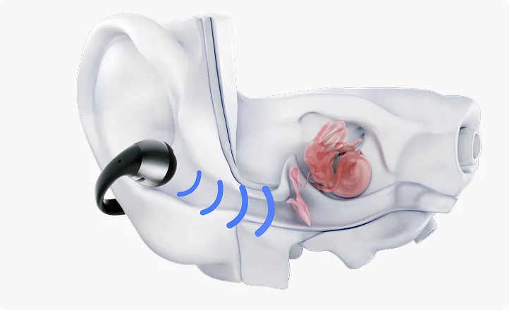 Open Ear Kopfhörer halten deine Ohren frei, belüftet und hygienisch. Hautfreundlich, weniger Irritationen, kontrollierter Schallverlust.