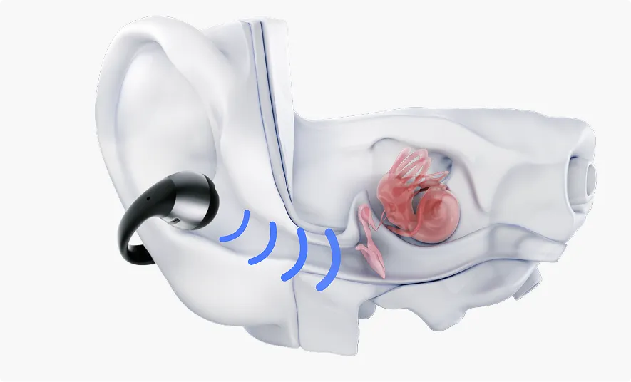 Open Ear Kopfhörer halten deine Ohren frei, belüftet und hygienisch. Hautfreundlich, weniger Irritationen, kontrollierter Schallverlust.